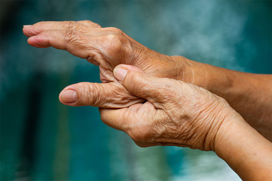 natural rheumatoid arthritis remedies