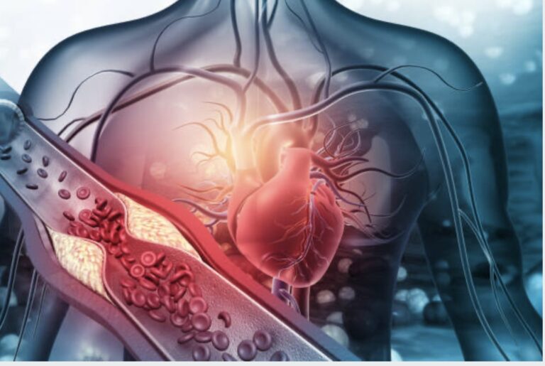 cardiovascular health